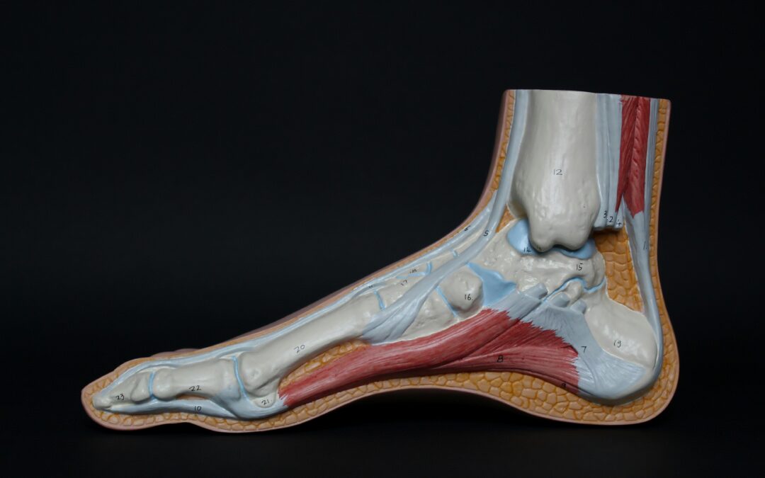 Why Do Athletes Keep Getting Stress Fractures? Look Beyond Training Load